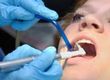 Information and Advice on Cosmetic Dentistry