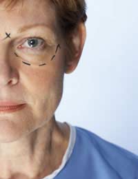 Cosmetic Surgery Facelift Surgery