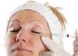 I Found Alternatives to Facial Cosmetic Surgery: A Case Study
