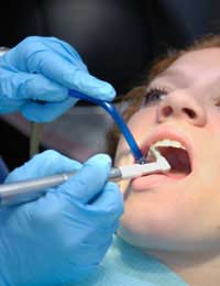 Cosmetic Dentistry Teeth Whitening Teeth